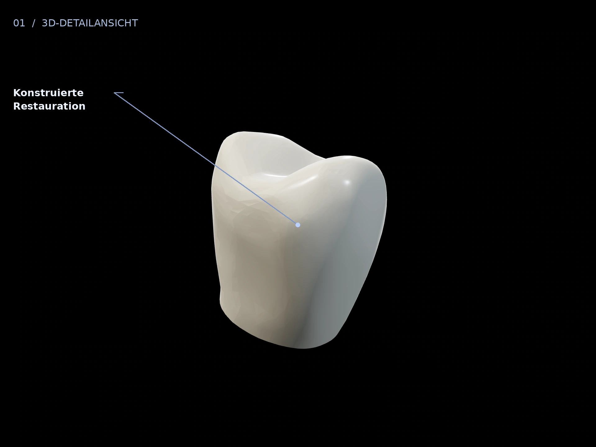 Grundform: beschriftete 3D-Ansicht mit Konstruierte Restauration
