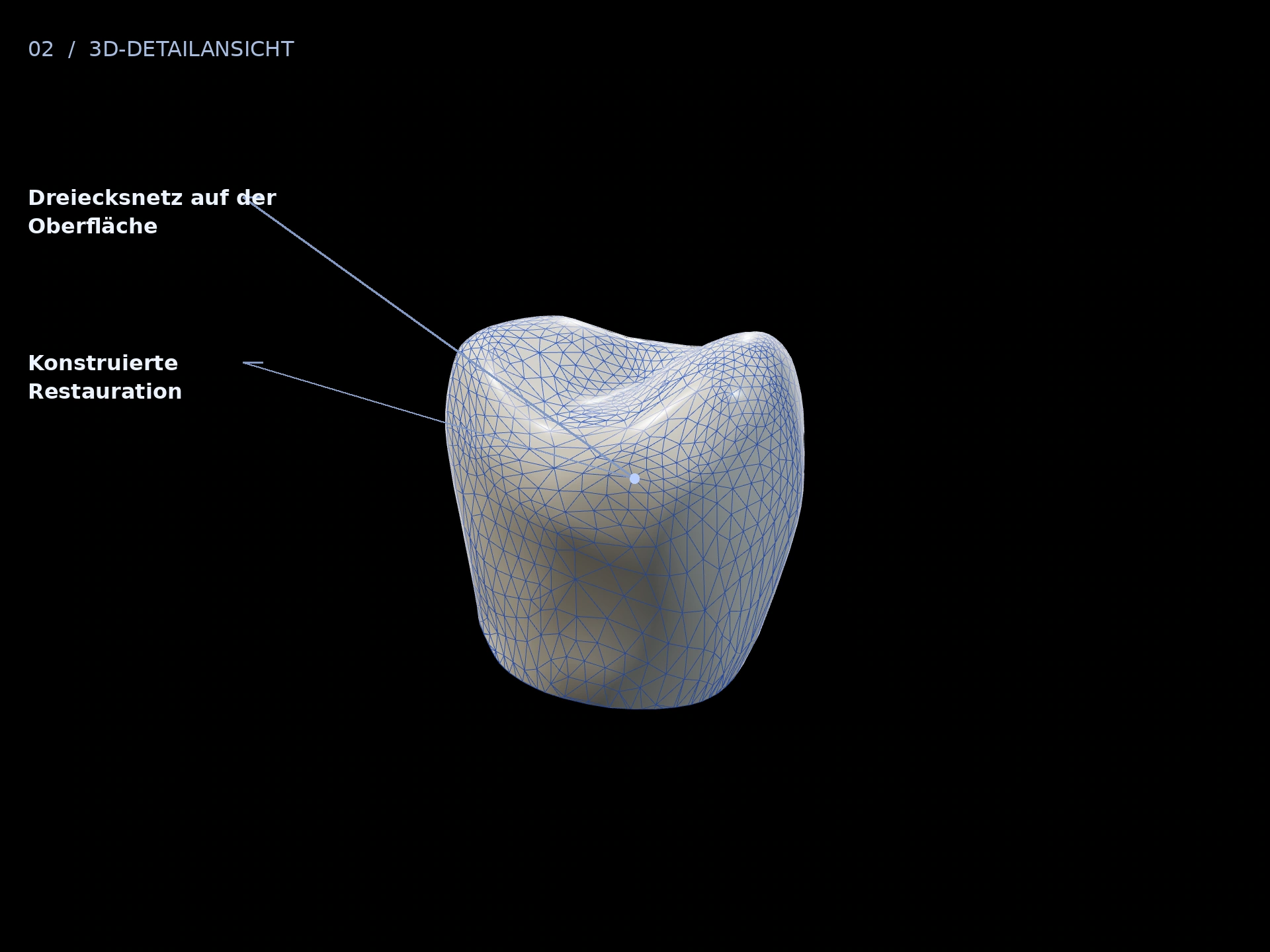 Dreiecke: beschriftete 3D-Ansicht mit Konstruierte Restauration, Dreiecksnetz auf der Oberfläche
