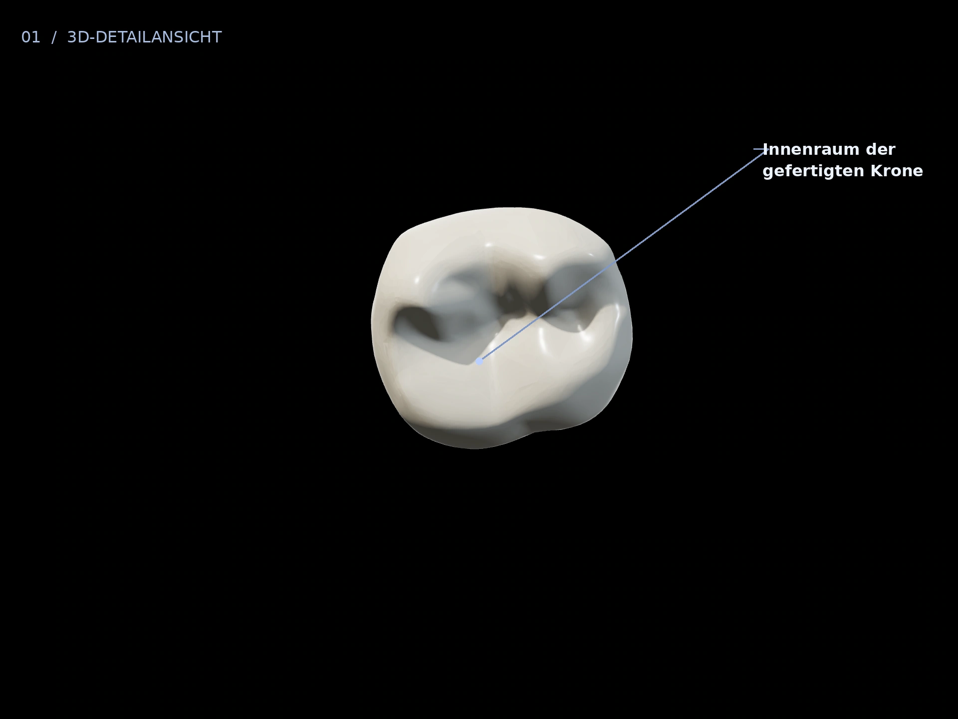 Innenraum: beschriftete 3D-Ansicht mit Innenraum der gefertigten Krone