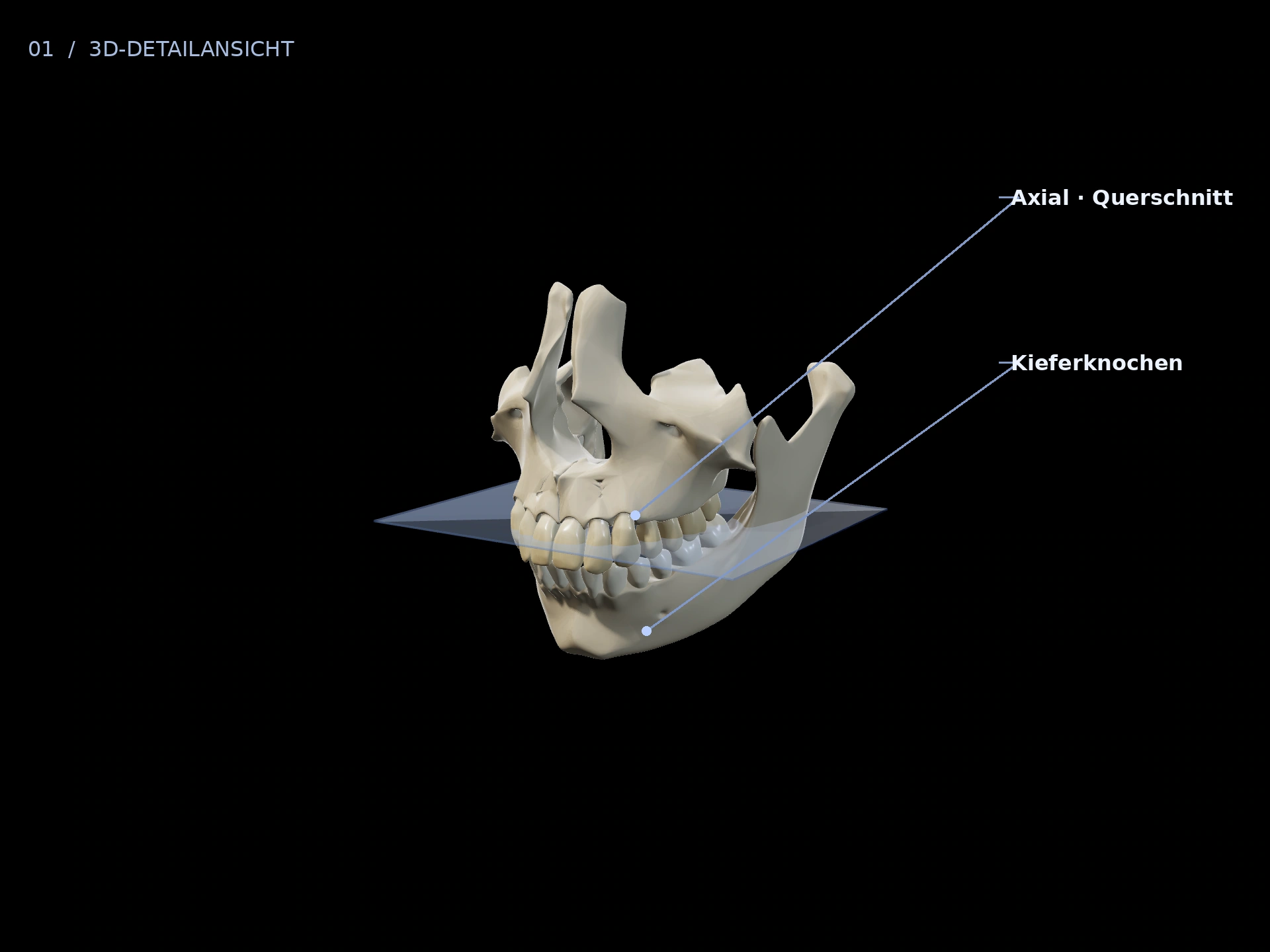 Querschnitt: beschriftete 3D-Ansicht mit Axial · Querschnitt, Kieferknochen