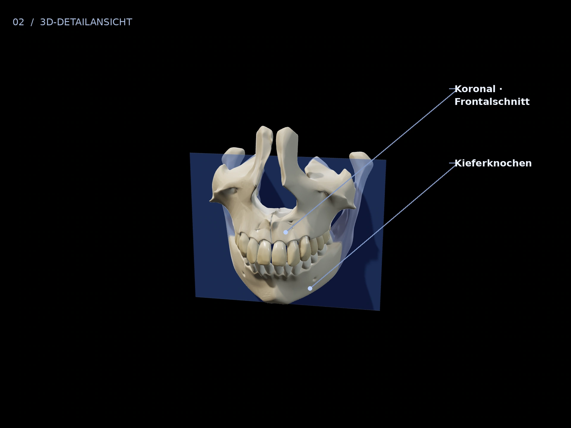 Frontalschnitt: beschriftete 3D-Ansicht mit Koronal · Frontalschnitt, Kieferknochen
