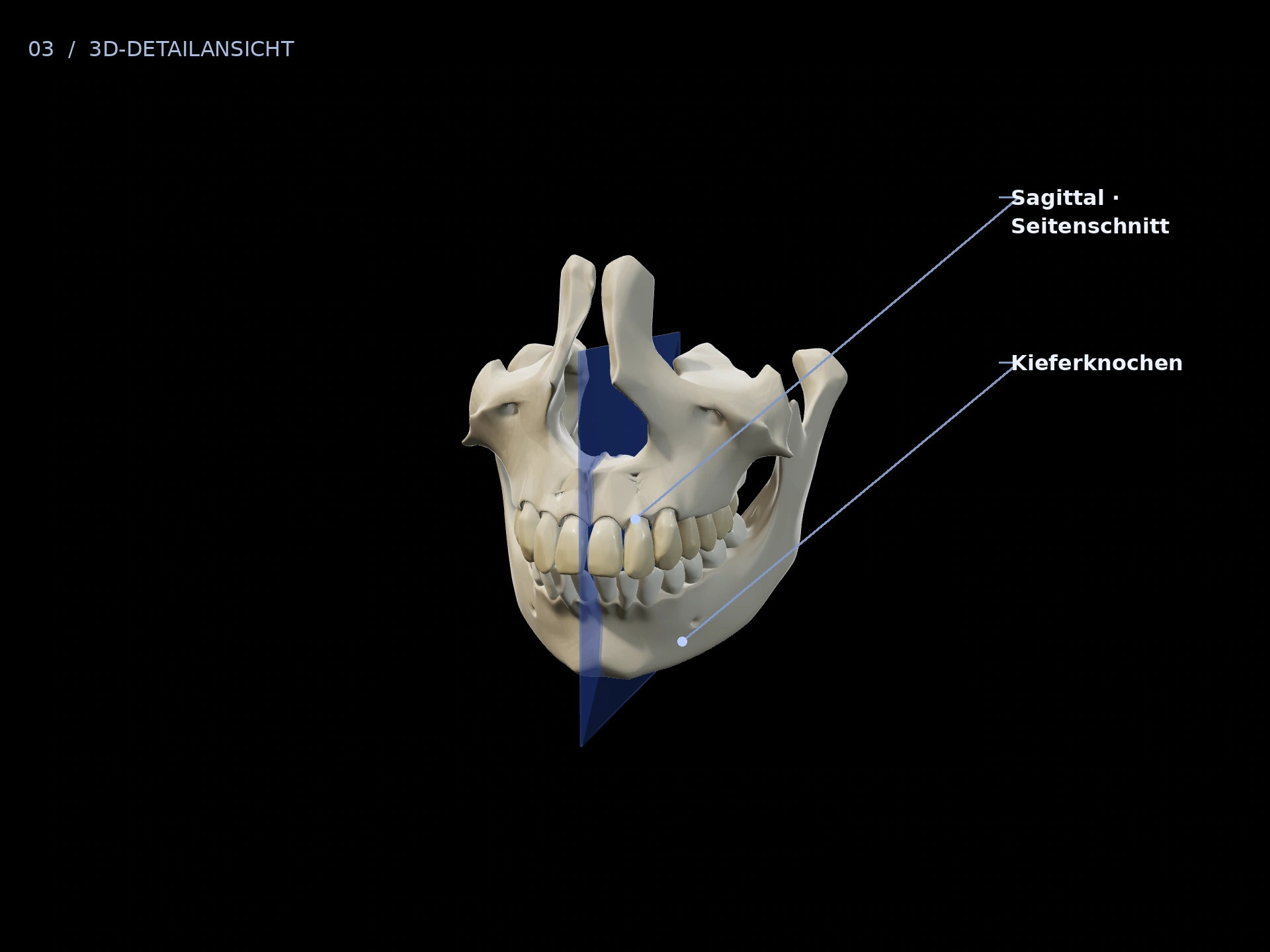 Seitenschnitt: beschriftete 3D-Ansicht mit Sagittal · Seitenschnitt, Kieferknochen