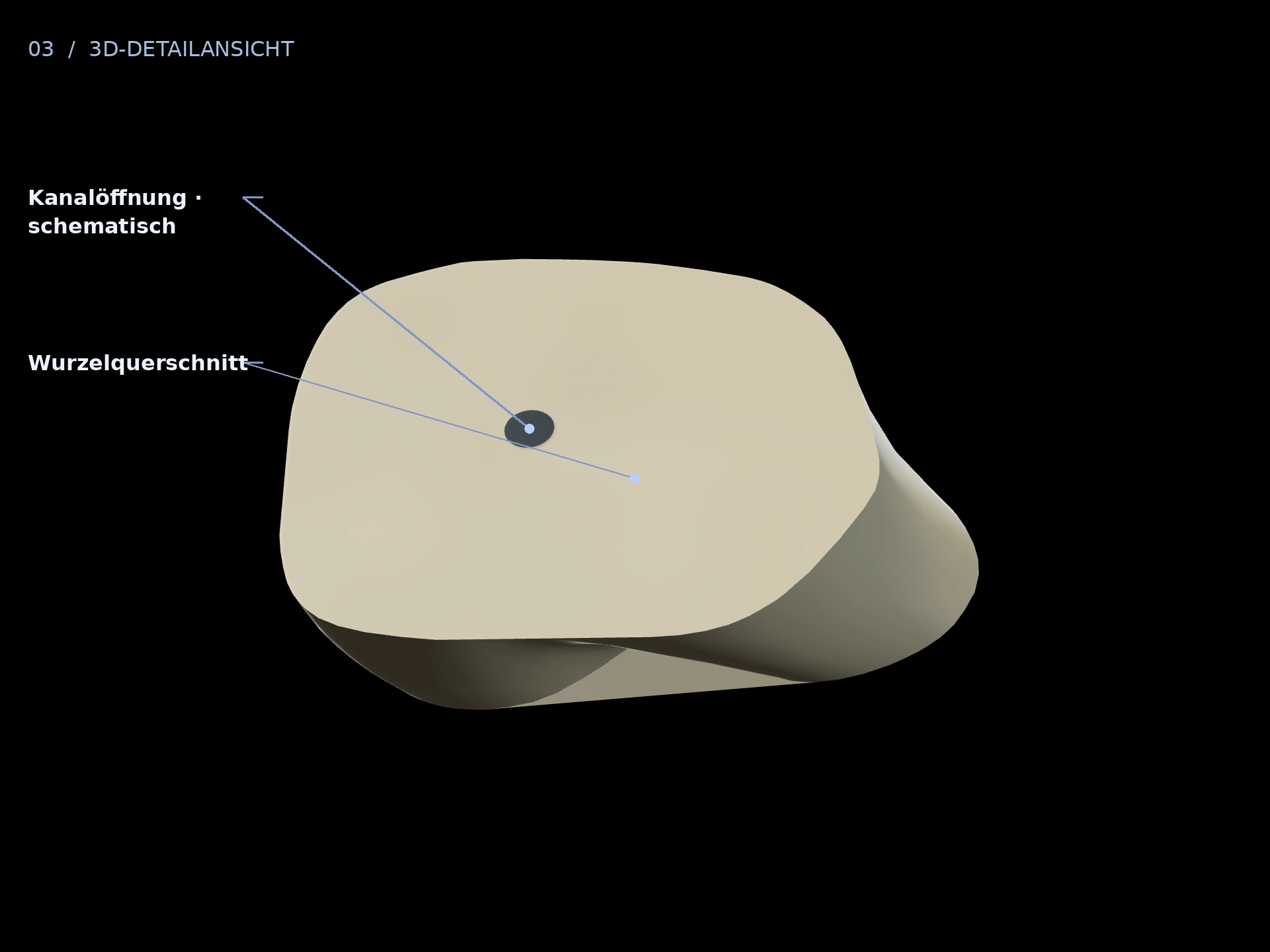 Kanalöffnung: beschriftete 3D-Ansicht mit Wurzelquerschnitt, Kanalöffnung · schematisch