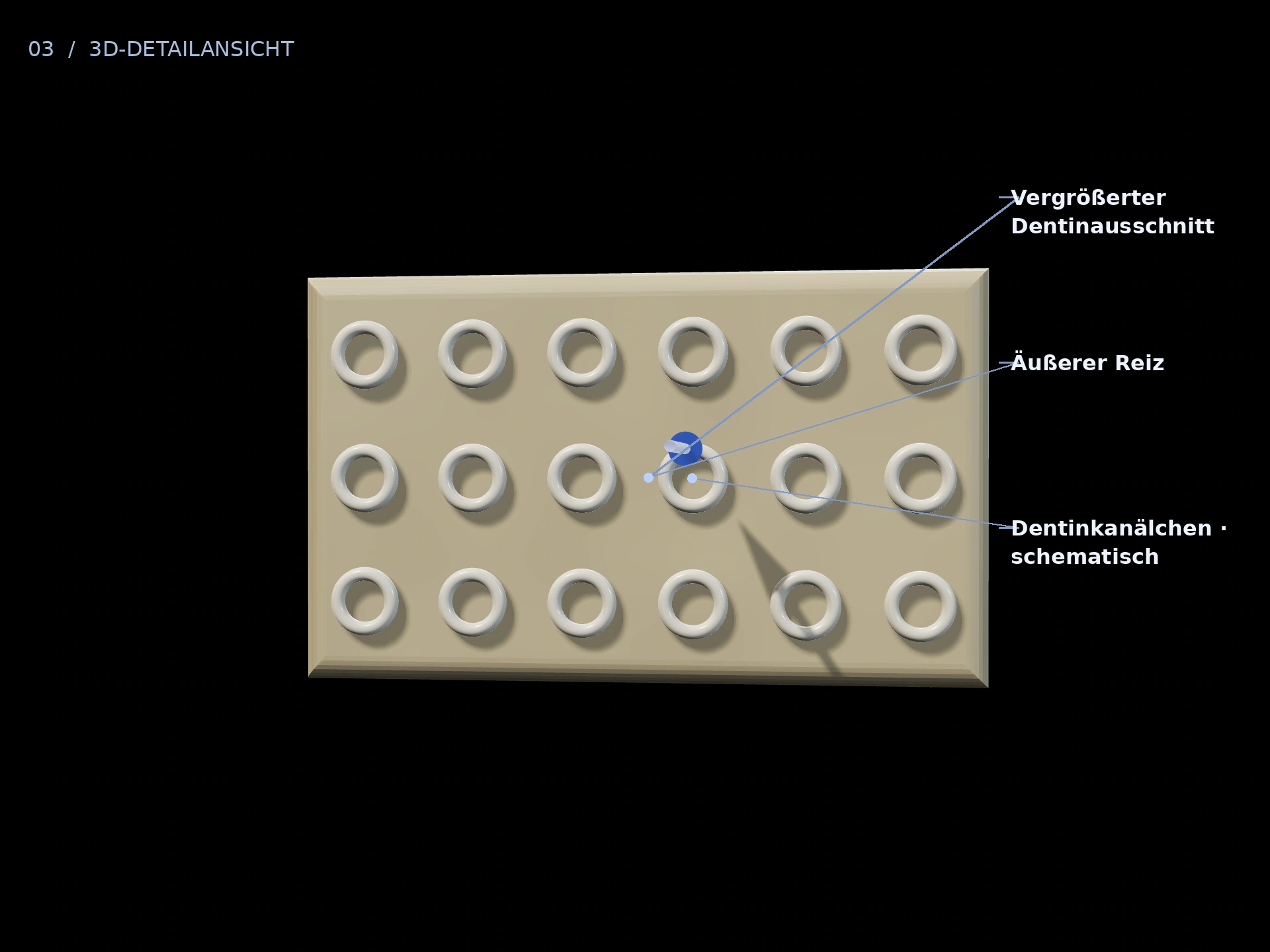 Äußerer Reiz: beschriftete 3D-Ansicht mit Vergrößerter Dentinausschnitt, Dentinkanälchen · schematisch, Äußerer Reiz