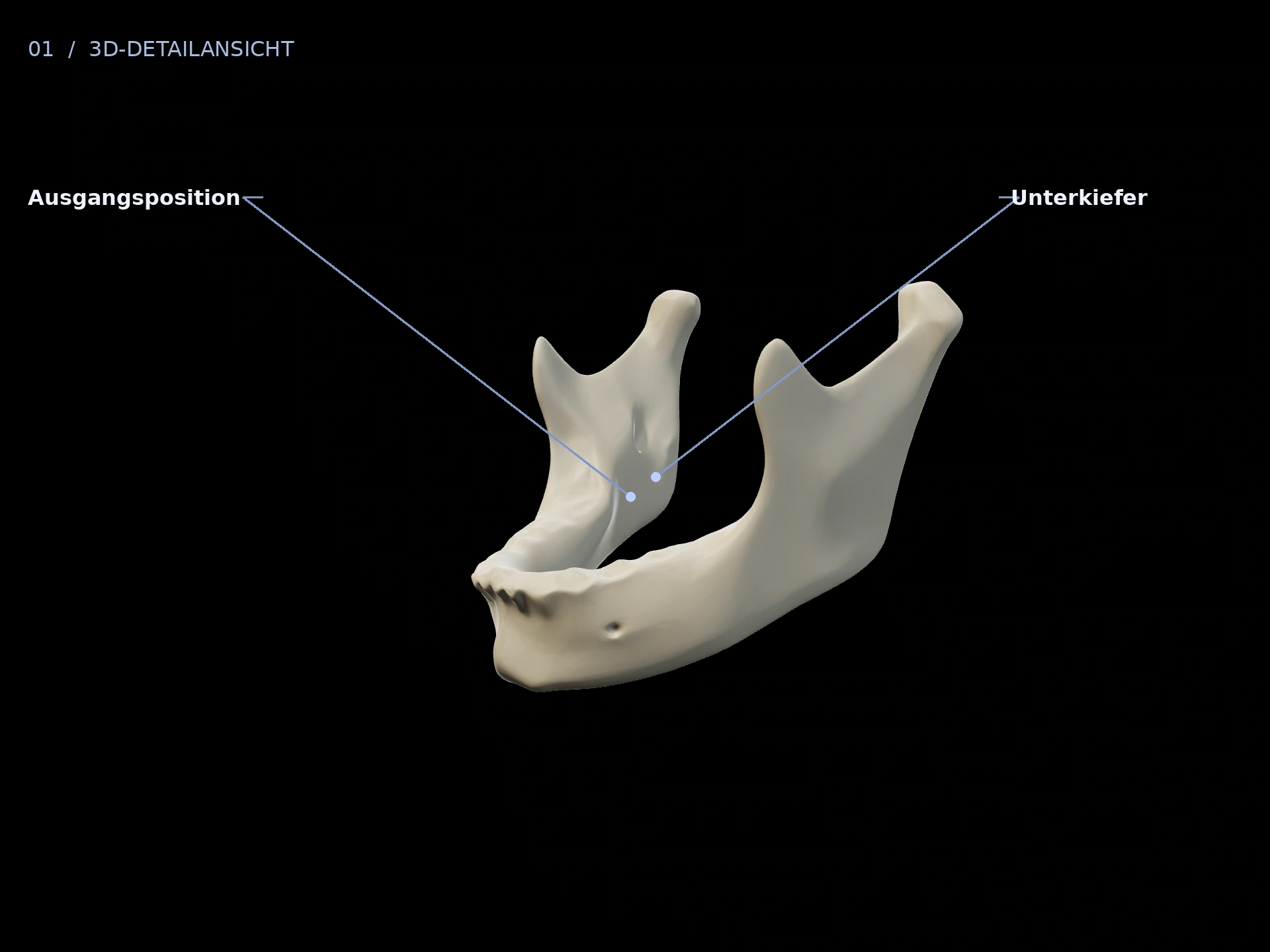 Ausgangslage: beschriftete 3D-Ansicht mit Unterkiefer, Ausgangsposition
