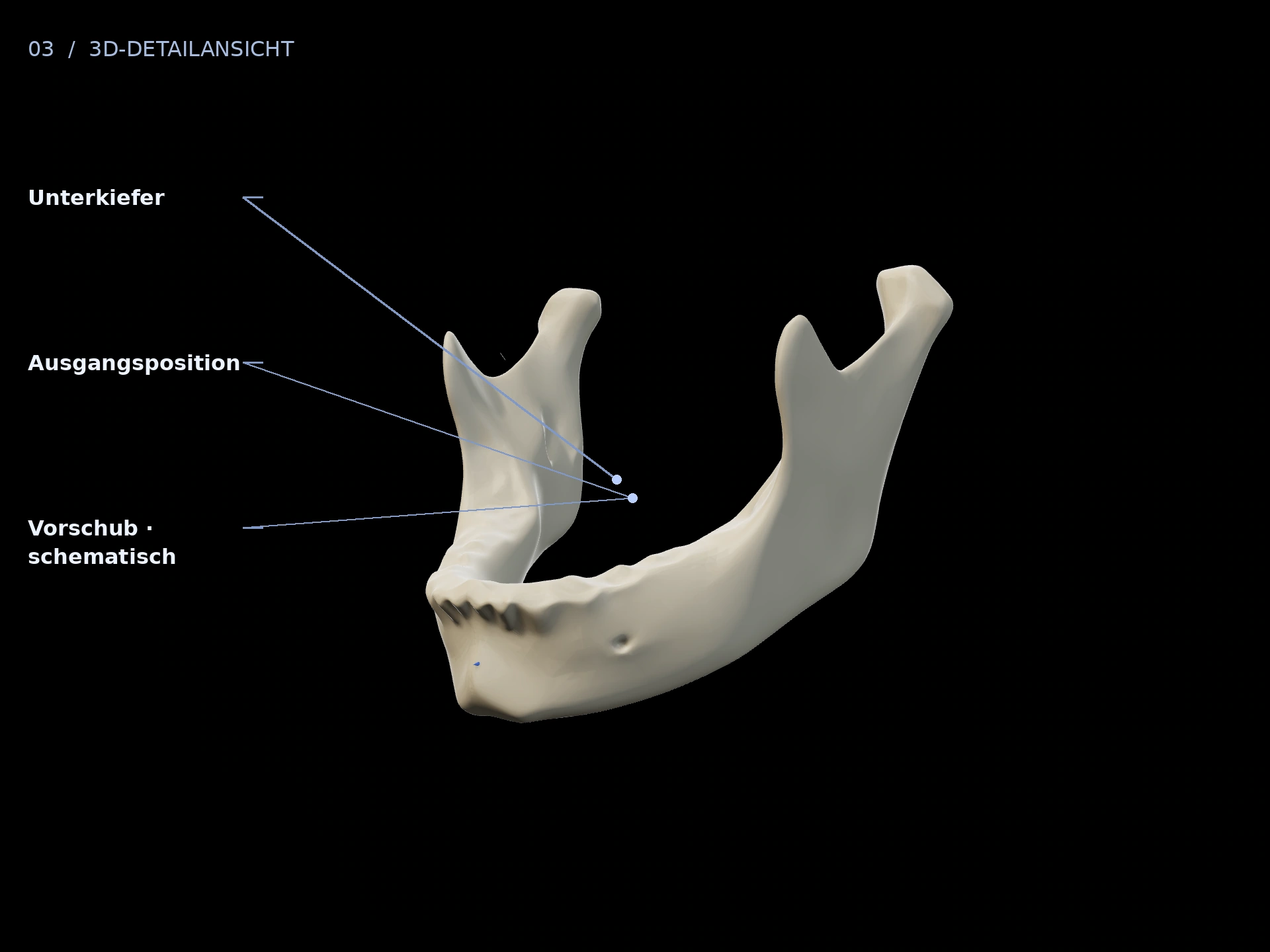 Positionen vergleichen: beschriftete 3D-Ansicht mit Unterkiefer, Ausgangsposition, Vorschub · schematisch