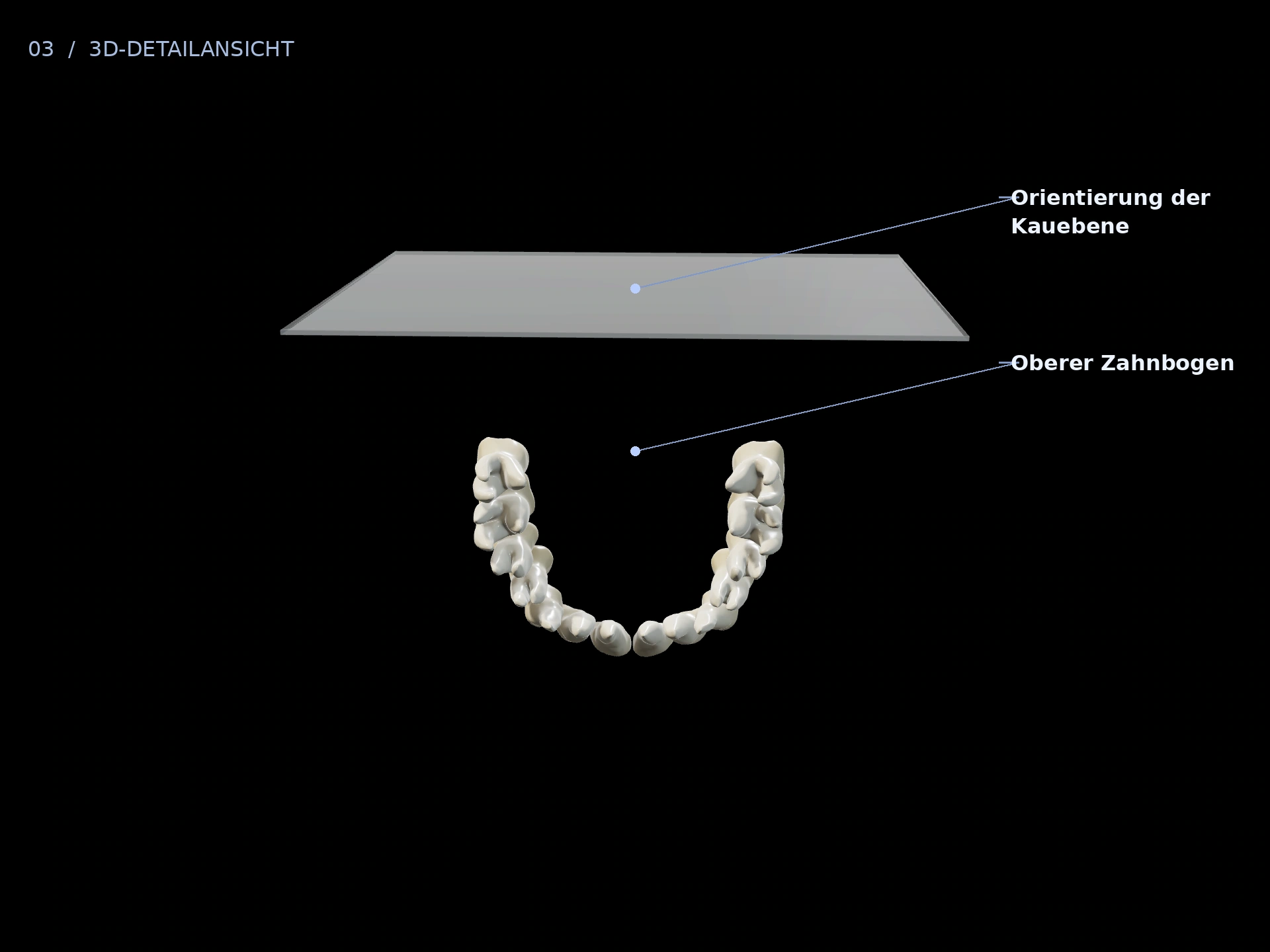 Gemeinsame Planung: beschriftete 3D-Ansicht mit Oberer Zahnbogen, Orientierung der Kauebene